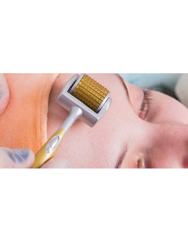 Derma roller